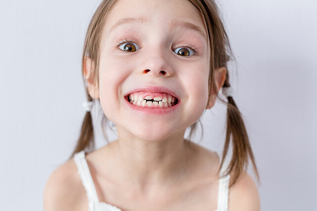 Nire hortzan erori zait.