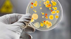 Timeline: Eventos importantes en Microbiología. Por Emeli Meza.