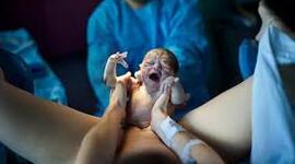 Timeline: Riesgos del parto