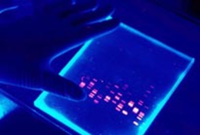 RFLP, DNA and Criminal Cases