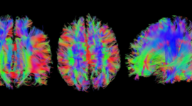 Timeline: Evolución de la neurociencia de la conducta