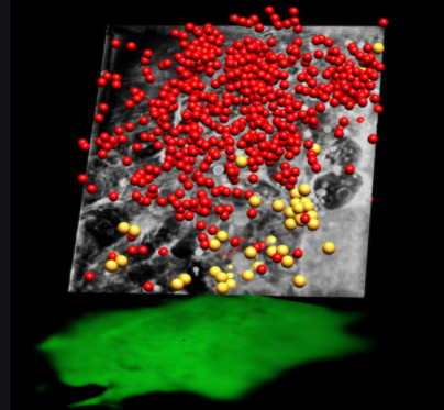 Microscopio de rayos x