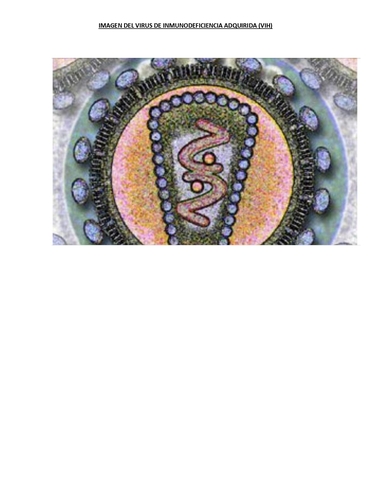 VIRUS DE INMUNODEFICIENCIA ADQUIRIDA (VIH)