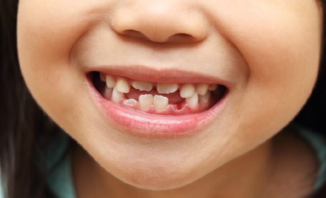 El meu primer dent definitiu.