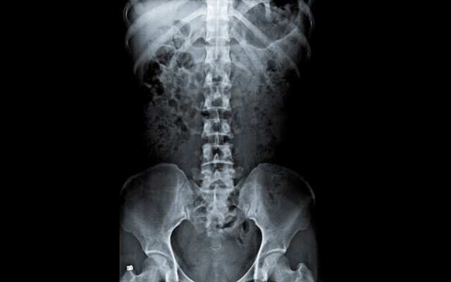 Invencion de la radiografia