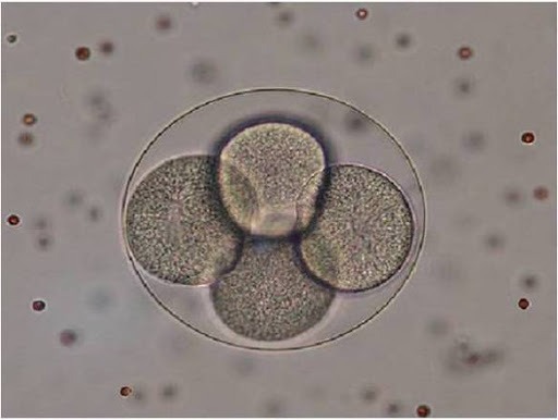 Teoría celular "Todos los seres vivientes están compuestos por células"