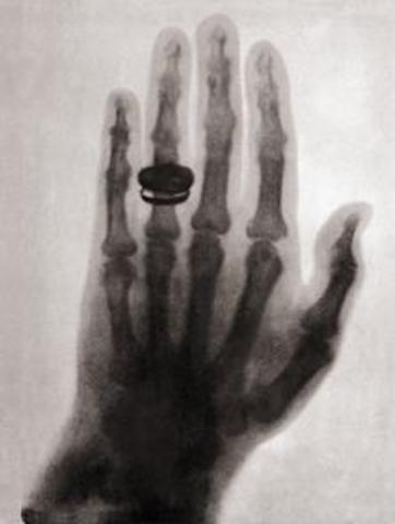 William Roentgen (1895)