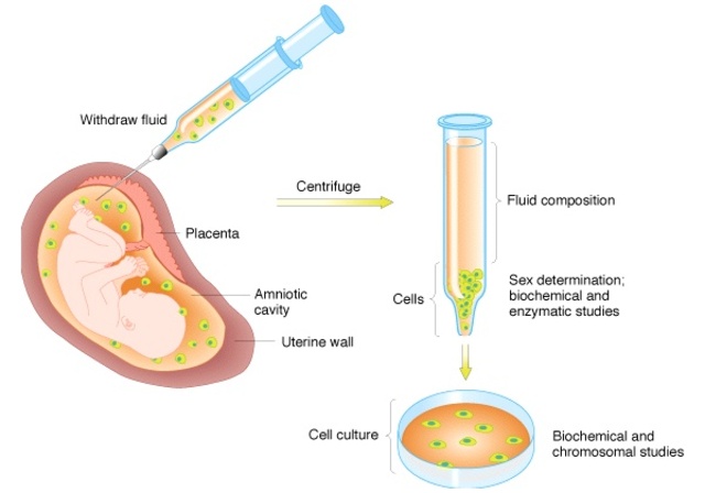 Recombinant DNA