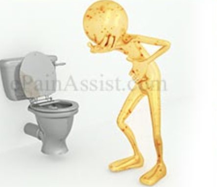 “Windscale- the Nuclear Laundry”