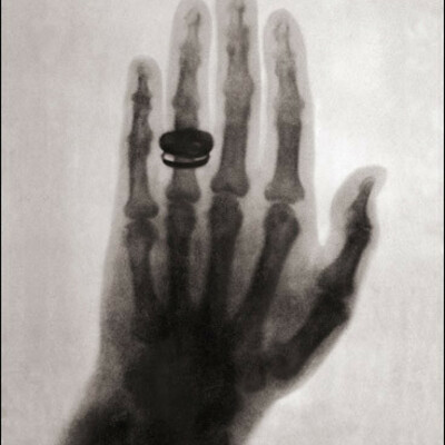 Timeline: Descubrimiento de los Rayos X