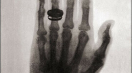 Timeline: Descubrimiento de los Rayos X