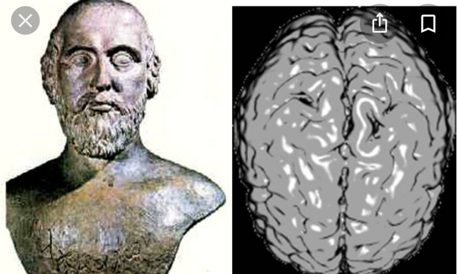Alcmeón de Crotona (500,450) A,C