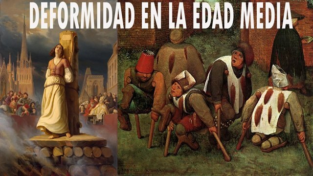 Discapacidad en la edad antigua. (En el Cristianismo)