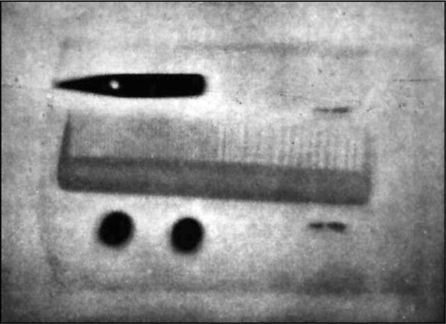 Primeras Radiografías en España