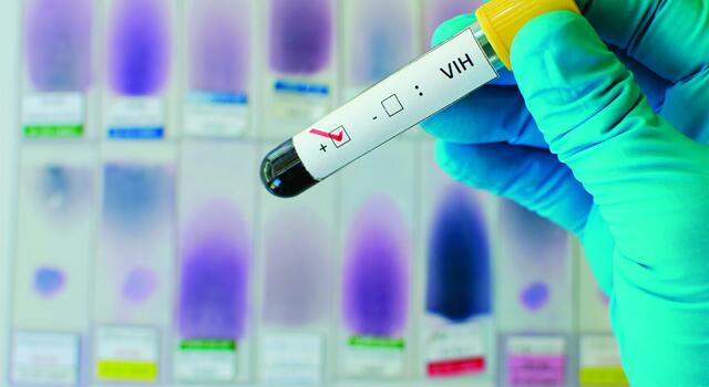 virus de la inmunodeficiencia