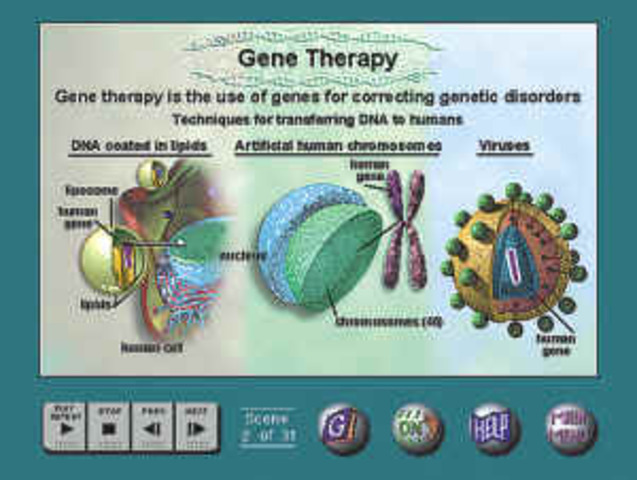 human insulin gene into bacteria