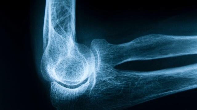 Publicación del hallazgo