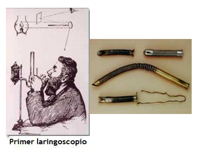 1880 - Macewen y 1895 - Dr. Chevalier