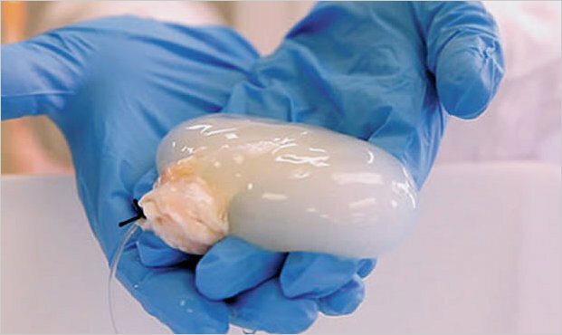 primer órgano en 3D