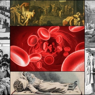 Timeline: 7. Enfermedades de la historia