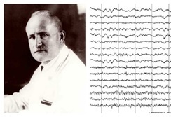 1937 – Hans Berger (1873 – 1941)  – Electroencefalografía