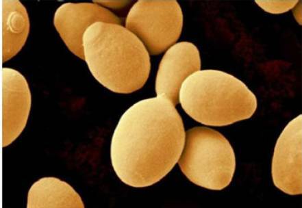 Biorreactor levadura