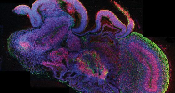 Biorreactor para el cultivo de células madre humanas