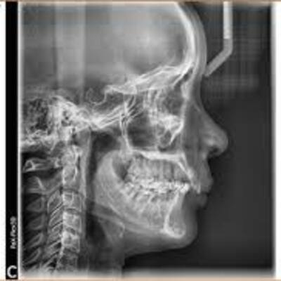 Timeline: Descubrimiento de los rayos X