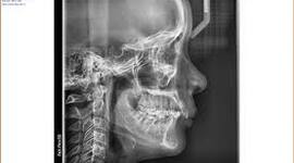 Timeline: Descubrimiento de los rayos X