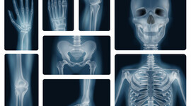 Timeline: Historia de los Rayos X