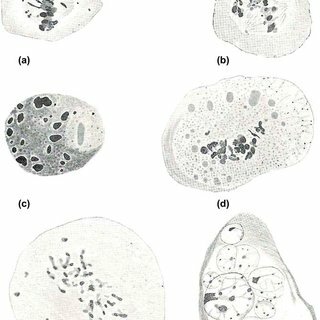 Ley de radiosensibilidad de los tejidos.