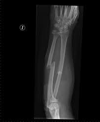 British Medical Journal