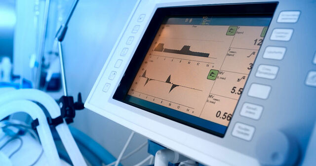 Punto de partida de la Ventilación Mecánica.