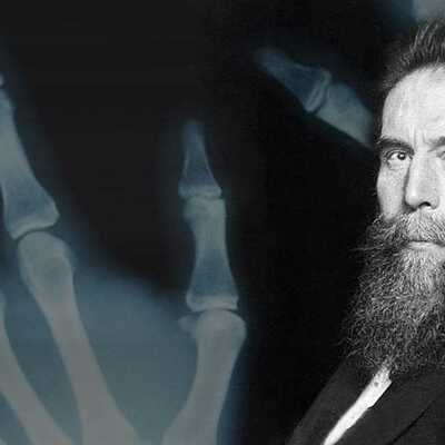 Timeline: Descubrimiento de los Rayos X