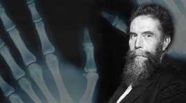 Timeline: Descubrimiento de los Rayos X