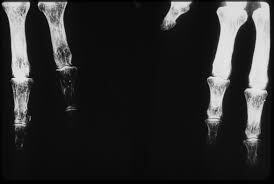 J. Bergonie y R. Tribondeau