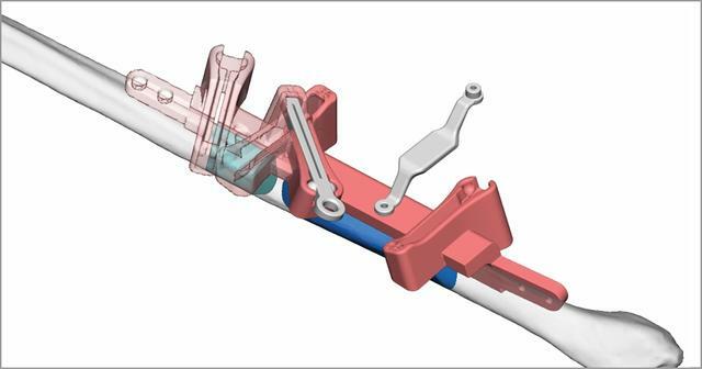 3D Systems expandió sus opciones con la planificación quirúrgica virtual (VSP) y productos y servicios 3D para el sector de la salud líderes en la industria