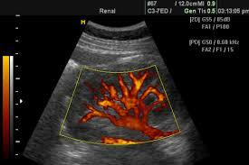 Primera ultrasonografía Doppler