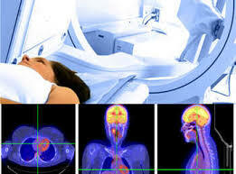 Medicina nuclear, radiodiagnóstica y radioterapia