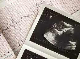 Radiografía Ginecológica