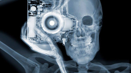 Timeline: Los Rayos X a través del tiempo.