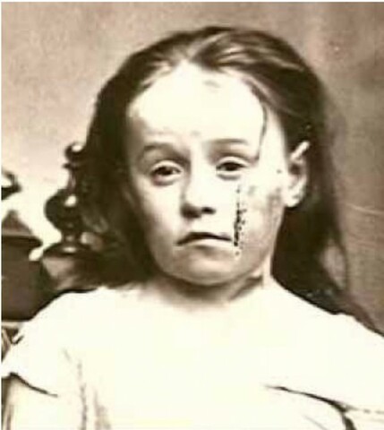 Primer caso a favor de una niña