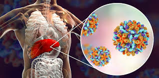 First Genetically engineered vaccine (hepatitis B)