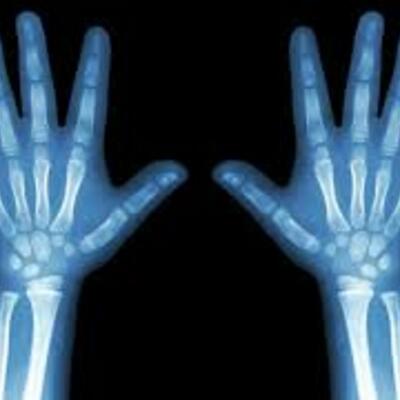 Timeline: Descubrimiento de los rayos X