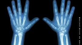 Timeline: Descubrimiento de los rayos X