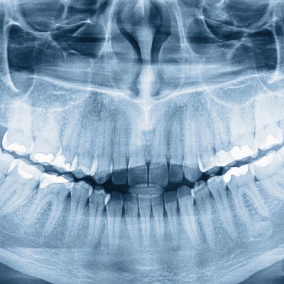 Timeline: Descubrimiento de los rayos X (100 años antes).