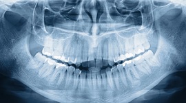 Timeline: Descubrimiento de los rayos X (100 años antes).