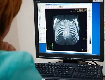 Primer sistema de Radiología digital directa.