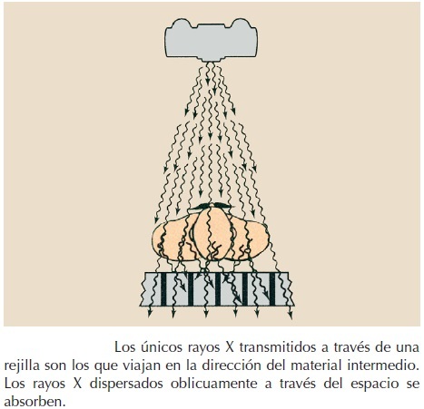 Rejilla de Bucke- Potter