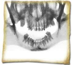 Primera radiografía dental